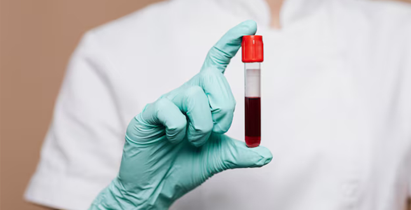 Laboratorijske analize